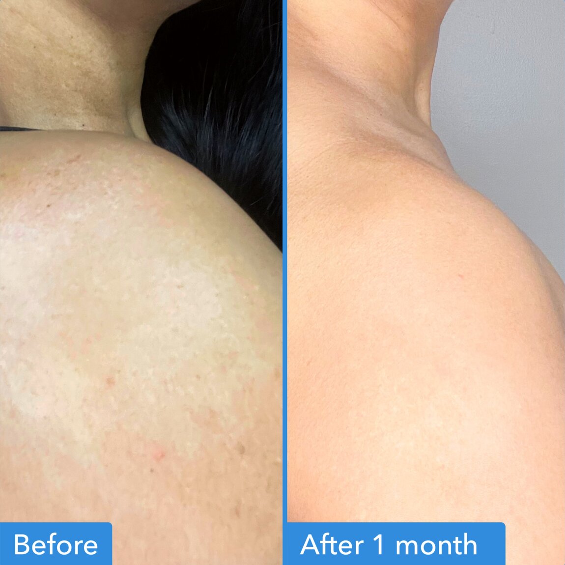 discoloration-correcting-body-treatment-n4 zb_p.jpg