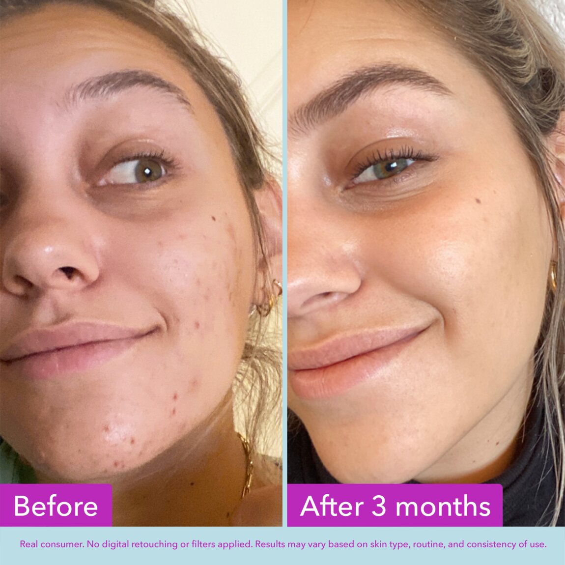 niacinamide-brightening-toner-y4 zb_p.jpg